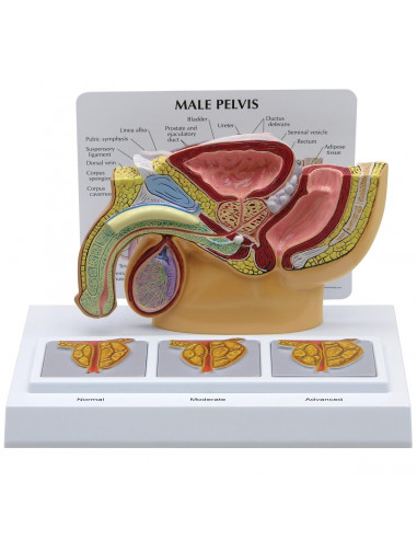 Modèle anatomique de bassin masculin avec prostate 3D en section 3B Scientific 1019563