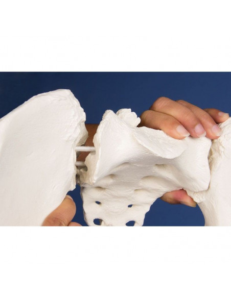 Erler Zimmer, colonne vertébrale lombaire, avec bassin et fémurs pour la démonstration des mauvaises positions, sur socle 4045G