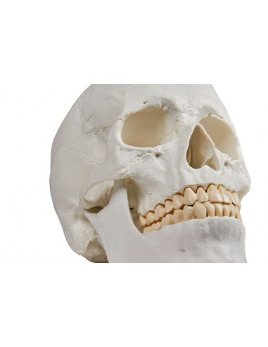 Erler Zimmer, Crâne, modèle...