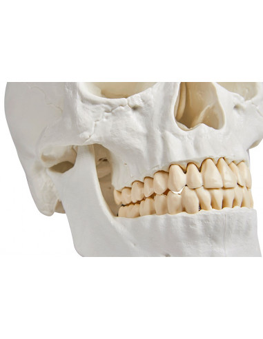 Erler Zimmer, Crâne, modèle...