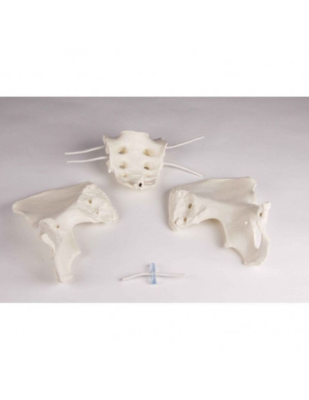 Erler Zimmer, colonne vertébrale lombaire, avec bassin et fémurs pour la démonstration des mauvaises positions, sur socle 4045G