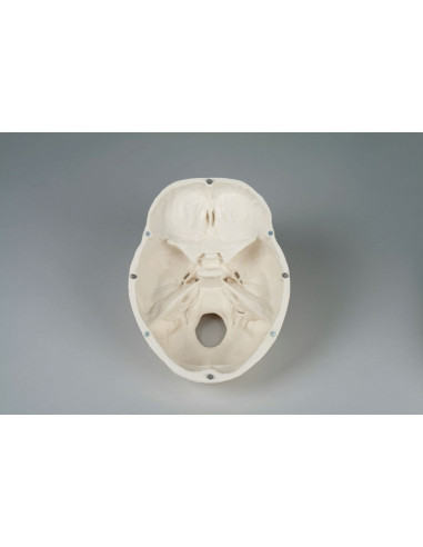 Erler Zimmer, Crâne, modèle...