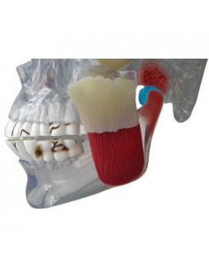 Erler Zimmer, modèle...