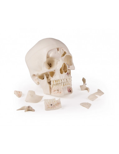Crâne de luxe pour les études...