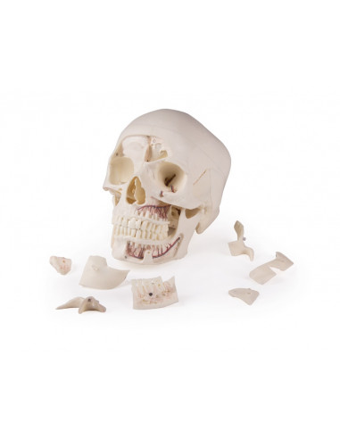 Crâne de luxe pour les études...