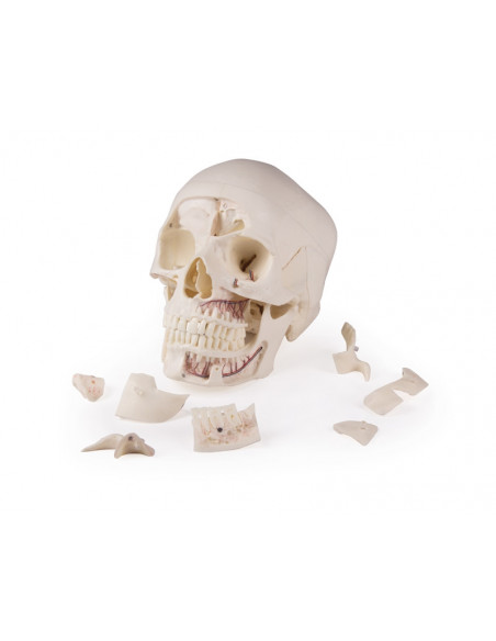 Crâne de luxe pour les études avancées, en 14 parties Erler Zimmer 4800