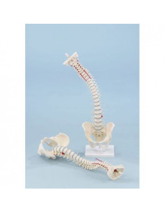 Erler Zimmer, Colonne...