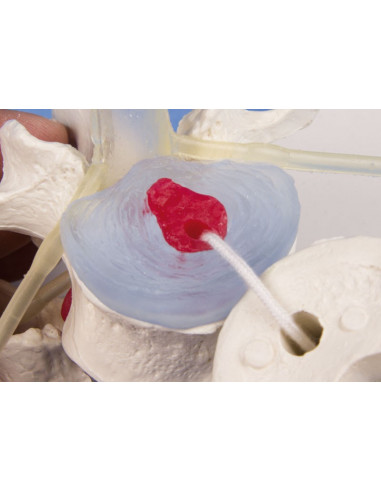 Erler Zimmer modèle anatomique...