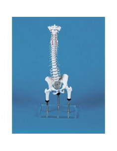 Erler Zimmer, Colonne...