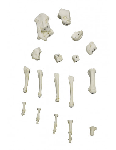 Squelette du pied à fixation...