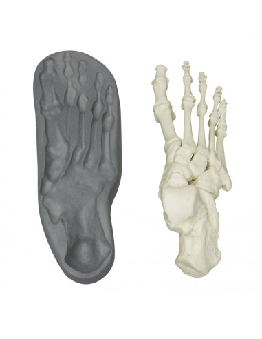 Squelette du pied à fixation...