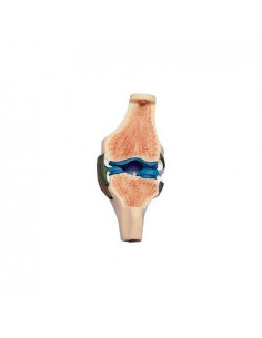 Section de l'articulation...