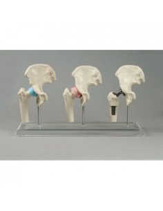 Erler Zimmer, modèle...