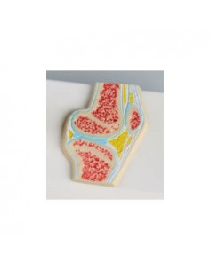 Erler Zimmer, petit modèle...