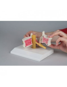 Erler Zimmer, modèle...