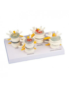 Erler Zimmer, modèle...