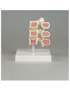 Erler Zimmer, modèle...