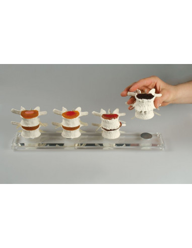 Erler Zimmer, modèle anatomique des...