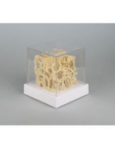 Erler Zimmer, comparaison...