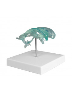 Ventricules du cerveau sur...