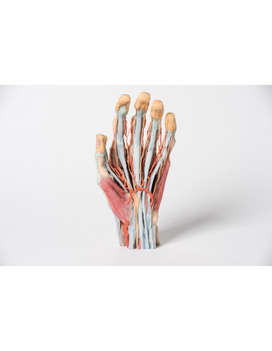 Dissection de la main Erler Zimmer...